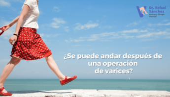 andar-despues-operacion-varices