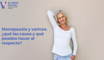 varices-menopausia
