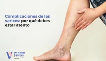 complicaciones-varices