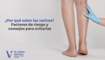 factores-riesgo-varices