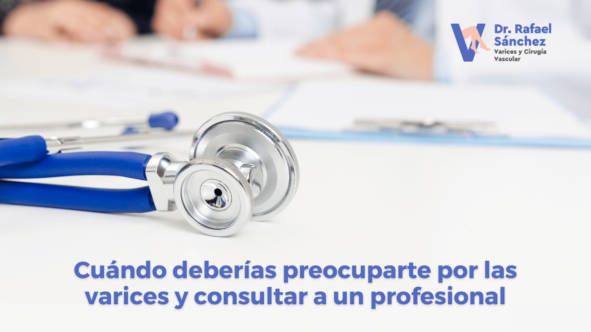 cuando-preocuparse-varices