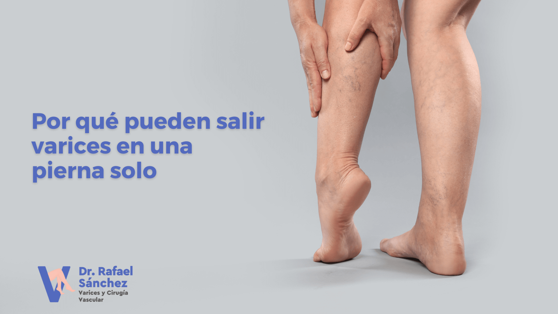 varices-una-pierna-solo