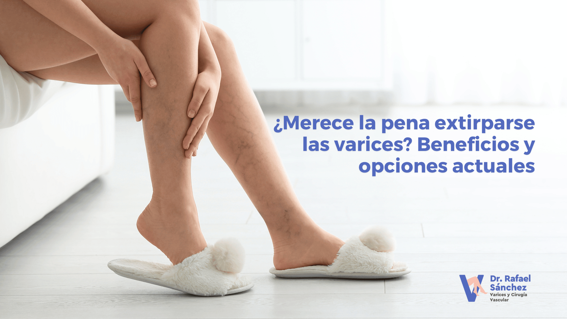 merece pena extirparse varices